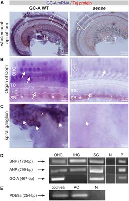 Guanylyl Cyclase A/cGMP Signaling Slows Hidden, Age- and Acoustic Trauma-Induced Hearing Loss